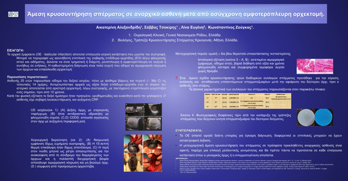 Preview of Άμεση κρυοσυντήρηση σπέρματος σε ανορχικό ασθενή μετά από ασύγχρονη αμφοτερόπλευρη ορχεκτομή.