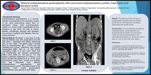Preview of Bilateral emphysematous pyelonephritis with concurrent emphysematous cystitis: Case report and literature review