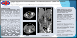Thumbnail for Bilateral emphysematous pyelonephritis with concurrent emphysematous cystitis: Case report and literature review