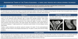 Thumbnail for Adenomatoid Tumor of the Tunica Albuginea - a rare case treated with organ sparing technique