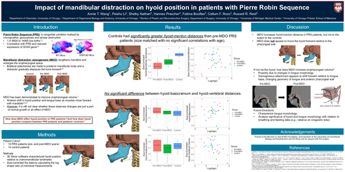 Preview of Impact Of Mandibular Distraction On Hyoid Position In Patients With Pierre Robin Sequence