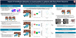 Thumbnail for Impact Of Mandibular Distraction On Hyoid Position In Patients With Pierre Robin Sequence