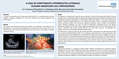 Preview of A case of symptomatic hyperreactio luteinalis causing significant leg lymphoedema