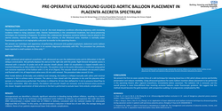 Thumbnail for PRE-OPERATIVE ULTRASOUND GUIDED AORTIC BALLOON PLACEMENT IN PLACENTA ACCRETA SPECTRUM