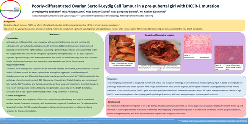 Preview of Poorly-differentiated Ovarian Sertoli-Leydig Cell Tumour in a pre-pubertal girl with DICER-1 mutation