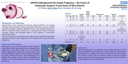 Thumbnail for vNOTES salpingectomy for ectopic pregnancy: A case series of seven patients