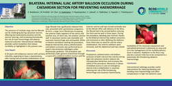 Thumbnail for BILATERAL INTERNAL ILIAC ARTERY BALLOON OCCLUSION DURING CAESAREAN SECTION FOR PREVENTING HAEMORRHAGE
