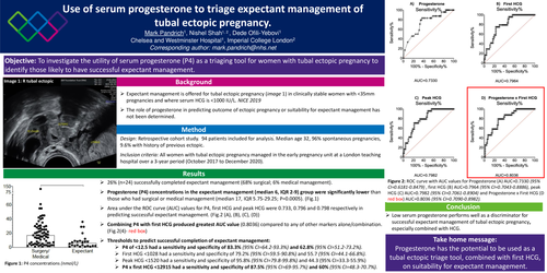Preview of Use of serum progesterone to triage expectant management of tubal ectopic pregnancy.
