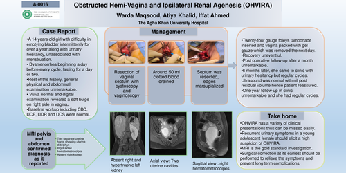 Preview of OHVIRA presenting with intermittent urinary tract obstruction