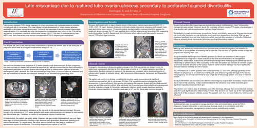 Preview of Late miscarriage due to ruptured tubo-ovarian abscess secondary to perforated sigmoid diverticulitis