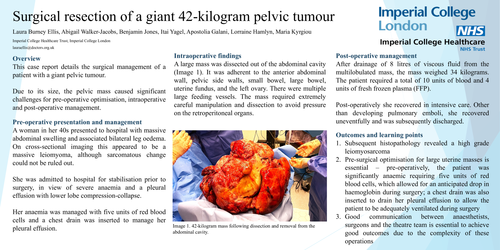 Preview of Surgical resection of a massive 42-kilogram pelvic tumour