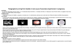 Thumbnail for PARAGANGLIOMA ARISING FROM BLADDER - A RARE CAUSE OF SECONDARY HYPERTENSION IN PREGNANCY