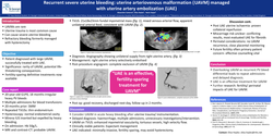 Thumbnail for Recurrent severe uterine bleeding: uterine arteriovenous malformation managed with uterine artery embolization