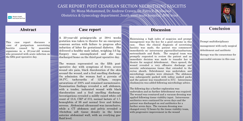 Preview of A case report: post cesarean section necrotizing fasciitis