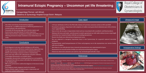 Preview of Intramural ectopic pregnancy , rare yet life threatening