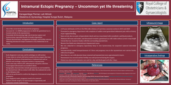 Thumbnail for Intramural ectopic pregnancy , rare yet life threatening