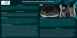 Thumbnail for Spontaneous Liver Capsule Rupture in Pregnancy