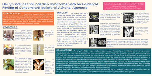 Preview of Herlyn Werner Wunderlich Syndrome with Incidental Finding of Unilateral Adrenal Gland Agenesis