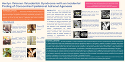 Thumbnail for Herlyn Werner Wunderlich Syndrome with Incidental Finding of Unilateral Adrenal Gland Agenesis
