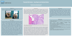 Thumbnail for Placental site nodule – a case report and literature review