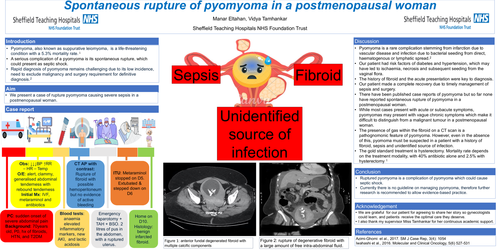 Preview of Spontaneous rupture of pyomoma in a postmenopausal woman