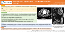 Preview of Management of a vaginal stone in a patient with cerebral palsy