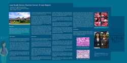 Thumbnail for A case report on low grade serous ovarian cancer (LGSOC)