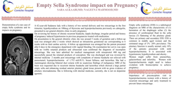 Thumbnail for Empty sella syndrome impact on pregnancy .