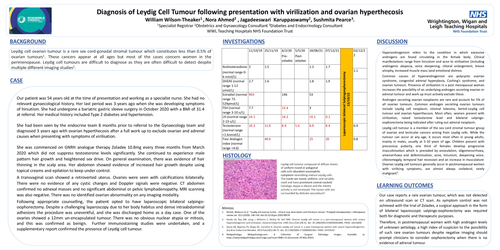 Preview of Diagnosis of Leydig Cell Tumour following presentation with virilisation and ovarian hyperthecosis