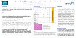 Thumbnail for Diagnosis of Leydig Cell Tumour following presentation with virilisation and ovarian hyperthecosis