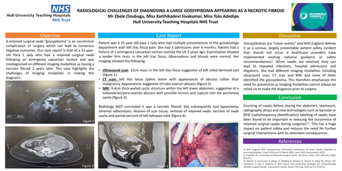 Preview of Radiological challenges of diagnosing a large Gossypiboma appearing as a necrotic fibroid
