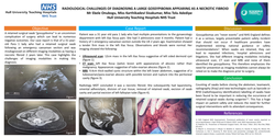 Preview of Radiological challenges of diagnosing a large Gossypiboma appearing as a necrotic fibroid