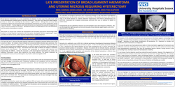 Thumbnail for Late presentation of broad ligament haematoma and uterine necrosis requiring hysterectomy