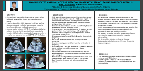 Preview of UNCOMPLICATED MATERNAL COVID 19 INFECTION IN ANTENATAL PERIOD LEADING TO HYDROPS FETALIS.