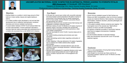 Thumbnail for UNCOMPLICATED MATERNAL COVID 19 INFECTION IN ANTENATAL PERIOD LEADING TO HYDROPS FETALIS.