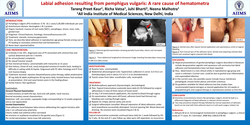 Thumbnail for Labial adhesion resulting from pemphigus vulgaris: A rare cause of hematometra