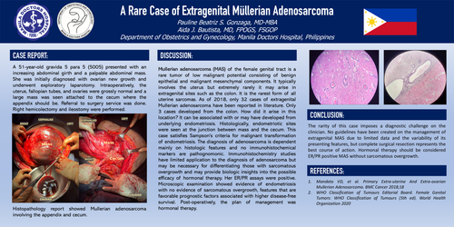 Preview of A RARE CASE OF EXTRAGENITAL MULLERIAN ADENOSARCOMA