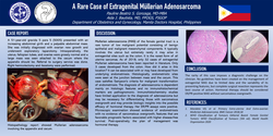 Thumbnail for A RARE CASE OF EXTRAGENITAL MULLERIAN ADENOSARCOMA