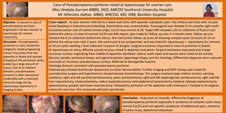 Thumbnail for Case of Pseudomyxoma peritonei noted at laparoscopy for ovarian cyst