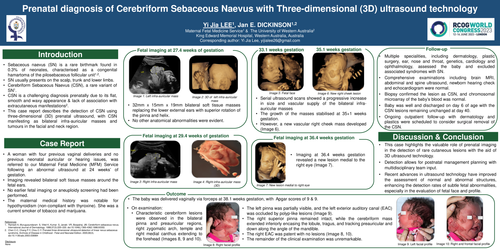 Preview of Prenatal diagnosis of Cerebriform Sebaceous Naevus with Three-Dimensional (3D) ultrasound technology