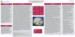 Thumbnail for Unusual Cause of Postpartum Fever: Hepatitis B