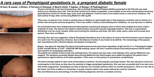 Preview of A rare case of Pemphigoid gestationis in pregnant diabetic female