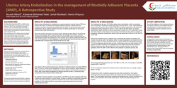 Thumbnail for Uterine Artery Embolization inthe Management of Morbidly Adherent Placenta, a Retrospective Study