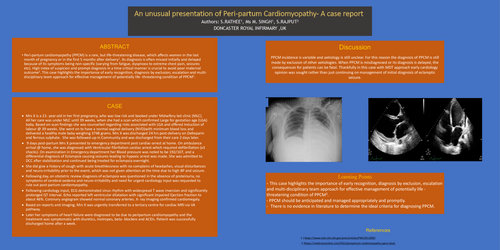 Preview of An unusual presentation of Peri-partum Cardiomyopathy- A case report
