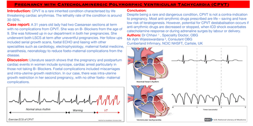 Preview of Pregnancy in Catecholaminergic Polymorphic Ventricular Tachycardia