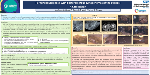 Preview of Peritoneal Melanosis with Bilateral Serous Cystadenomas of the Ovaries: A Case Report