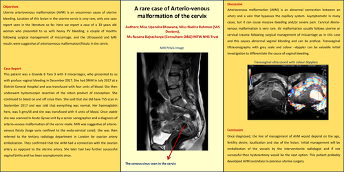 Preview of A rare case of Arterio-venous malformation of the cervix.