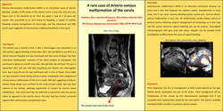 Thumbnail for A rare case of Arterio-venous malformation of the cervix.