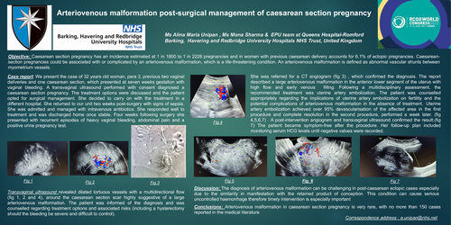 Preview of Arteriovenous malformation post-surgical management of caesarean section pregnancy