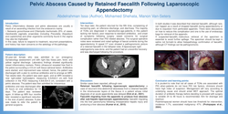 Thumbnail for Pelvic abscess caused by retained fecalith following laparoscopic appendectomy.